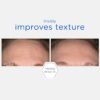NeoStrata Smooth Surface Daily Peel Pads - Image 5