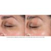 NeoStrata Tri-Therapy Lifting Serum - Image 4